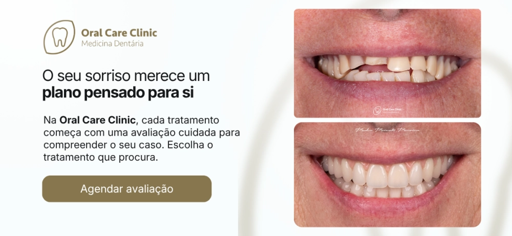 slide banner