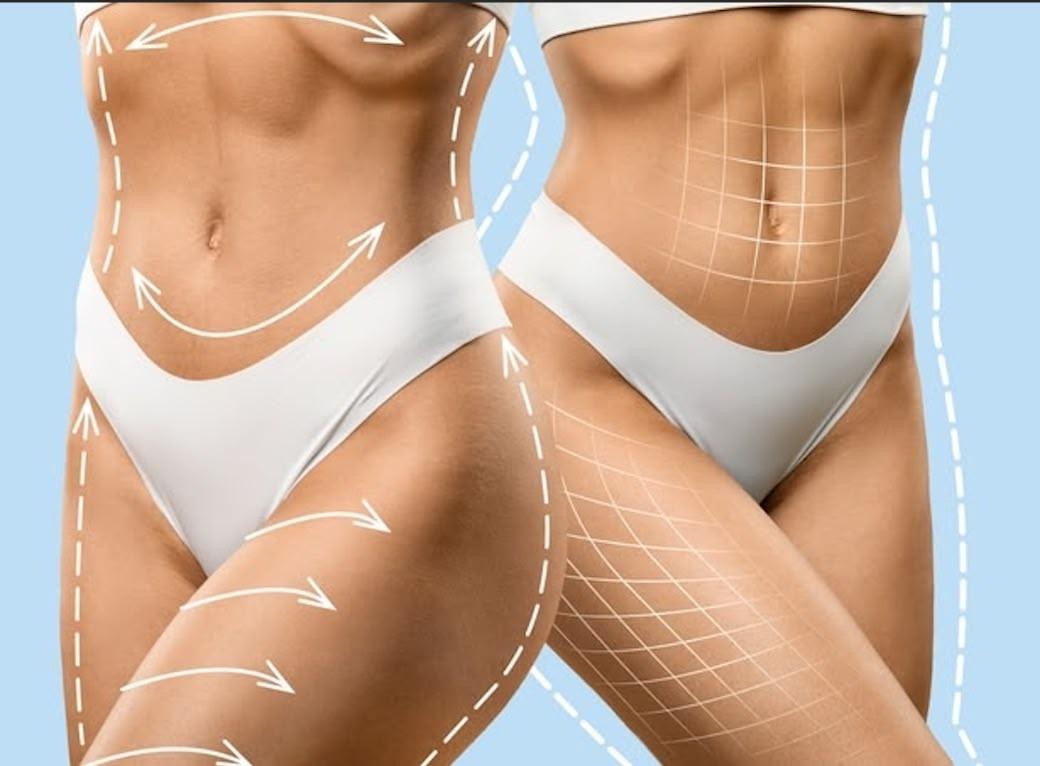form.banner_alt