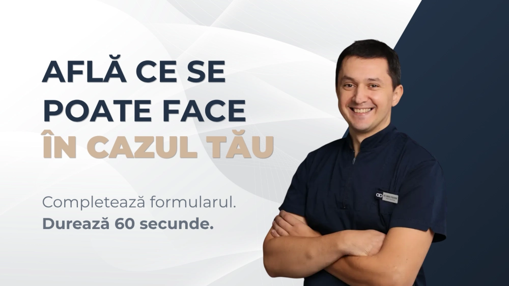 survey.slide_banner_alt