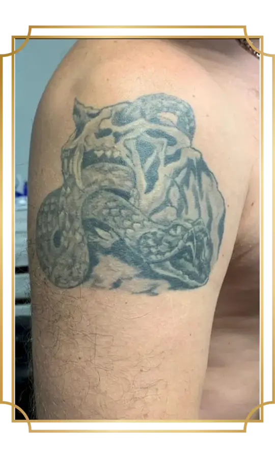 Faded tiger and snake tattoo on the upper arm before a tattoo cover-up