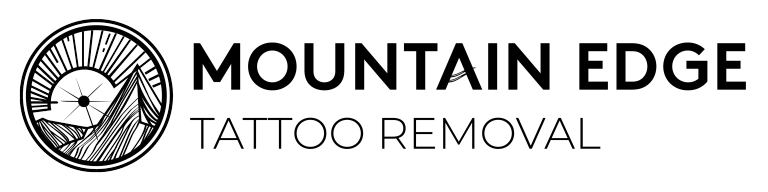 Laser Tattoo Removal Colorado Springs