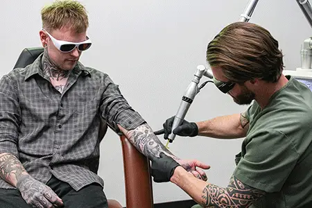 Laser Tattoo Removal in Colorado Springs