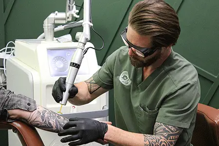 Full Tattoo Removal Services in Colorado Springs
