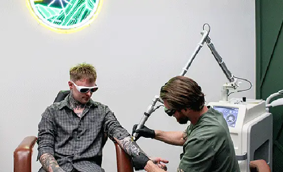 Best Laser Tattoo Removal in Colorado Springs, Colorado Mountain Edge