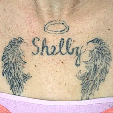 PicoWay® Laser Tattoo Removal Before Treatment | Mountain Edge CO