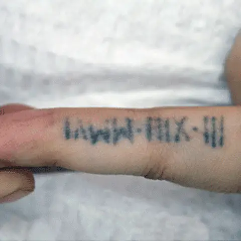 PicoWay® Laser Tattoo Removal Before Treatment | Mountain Edge CO