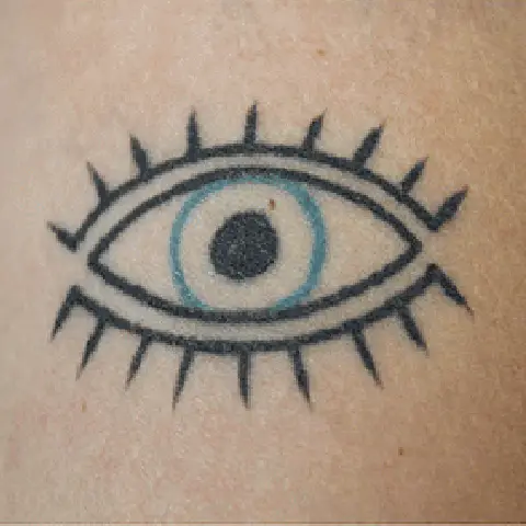 PicoWay® Laser Tattoo Removal Before Treatment | Mountain Edge CO