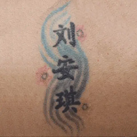 PicoWay® Laser Tattoo Removal Before Treatment | Mountain Edge CO
