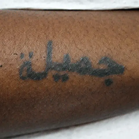 PicoWay® Laser Tattoo Removal Before Treatment | Mountain Edge CO