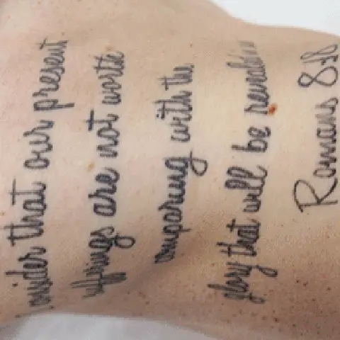 PicoWay® Laser Tattoo Removal Before Treatment | Mountain Edge CO