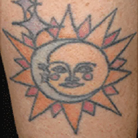 PicoWay® Laser Tattoo Removal Before Treatment | Mountain Edge CO