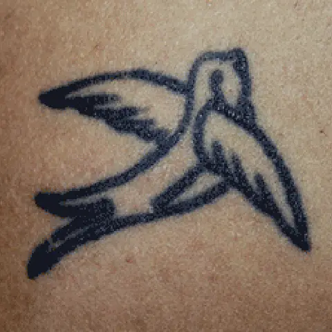 PicoWay® Laser Tattoo Removal Before Treatment | Mountain Edge CO