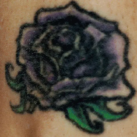 PicoWay® Laser Tattoo Removal Before Treatment | Mountain Edge CO