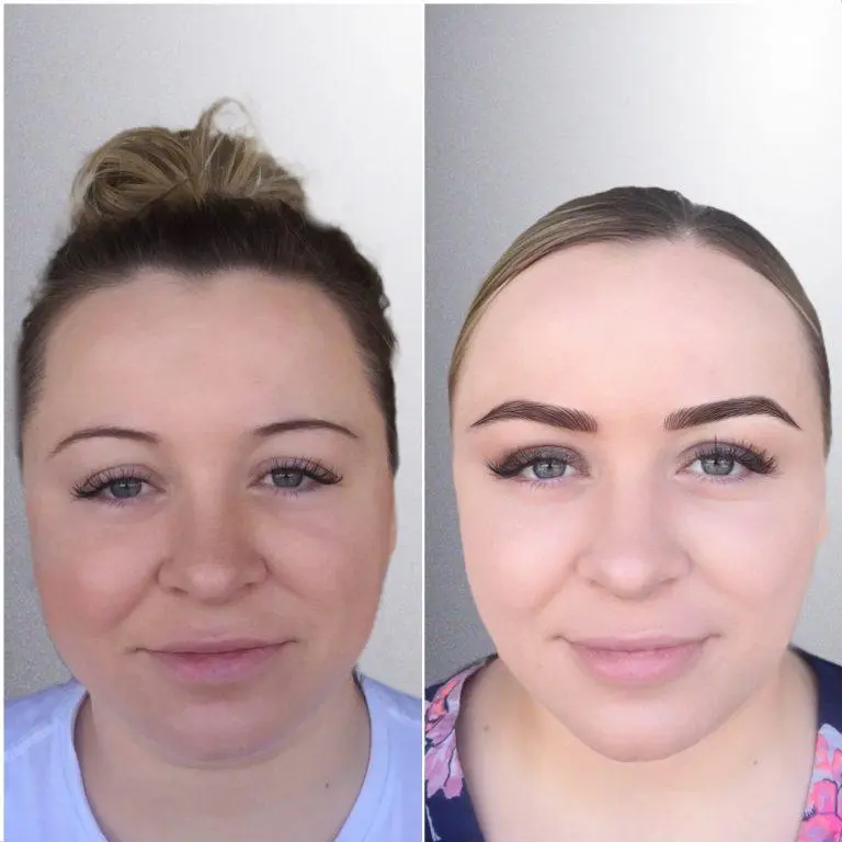 Brow transformation