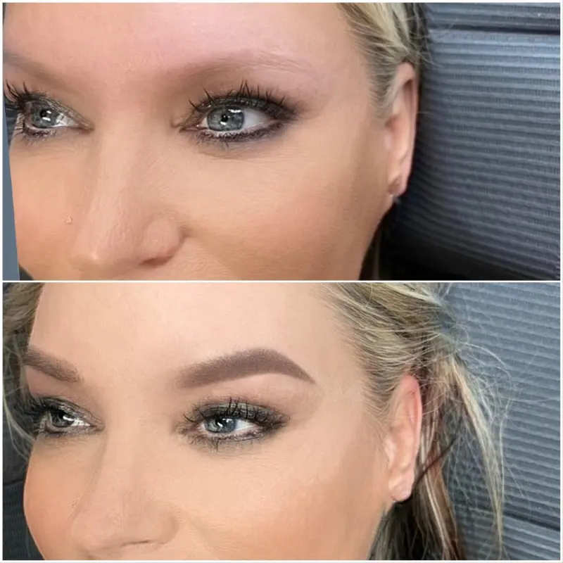 Brow result