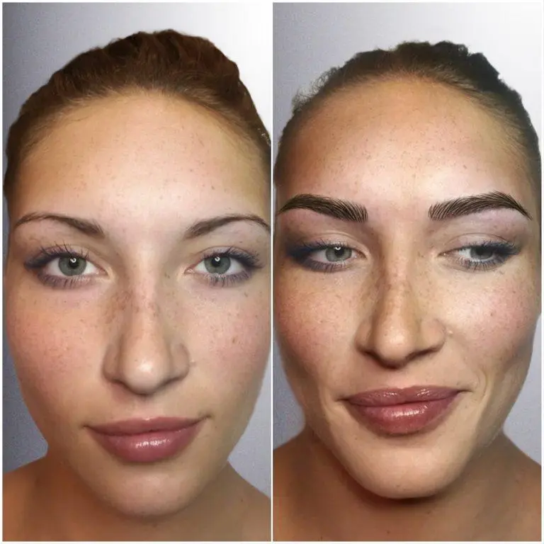 Brow before and after