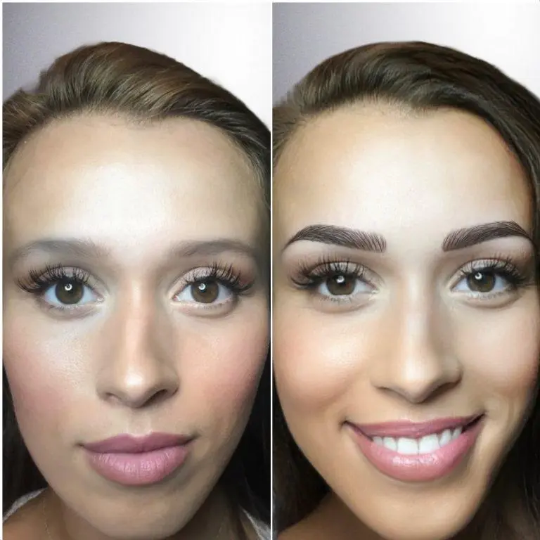 Brow result