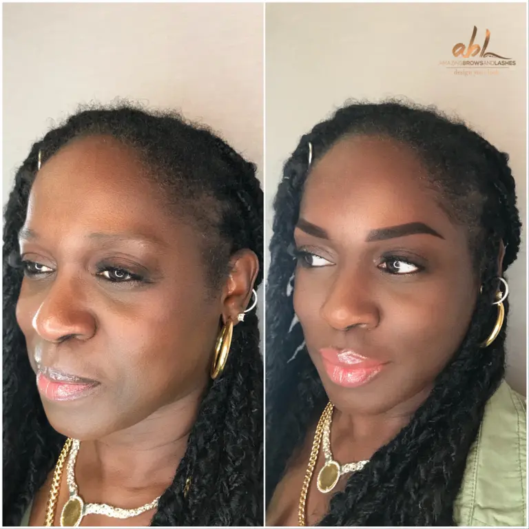 Brow transformation