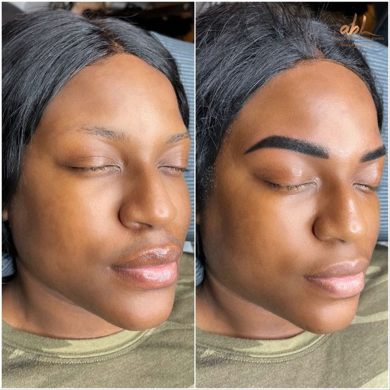 Brow result