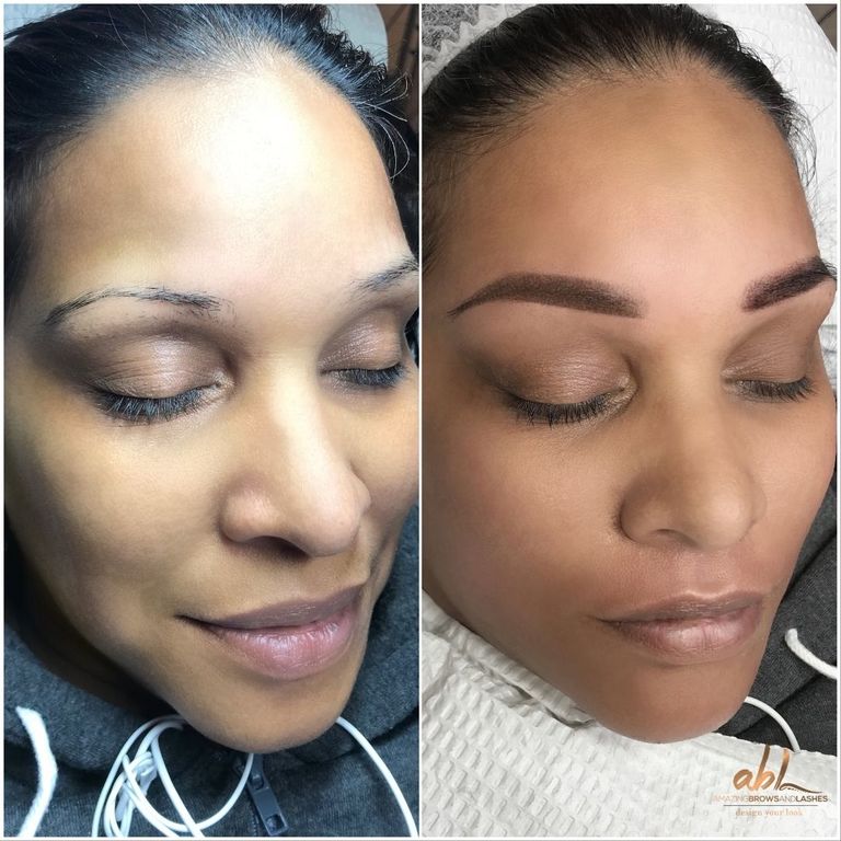 Brow transformation
