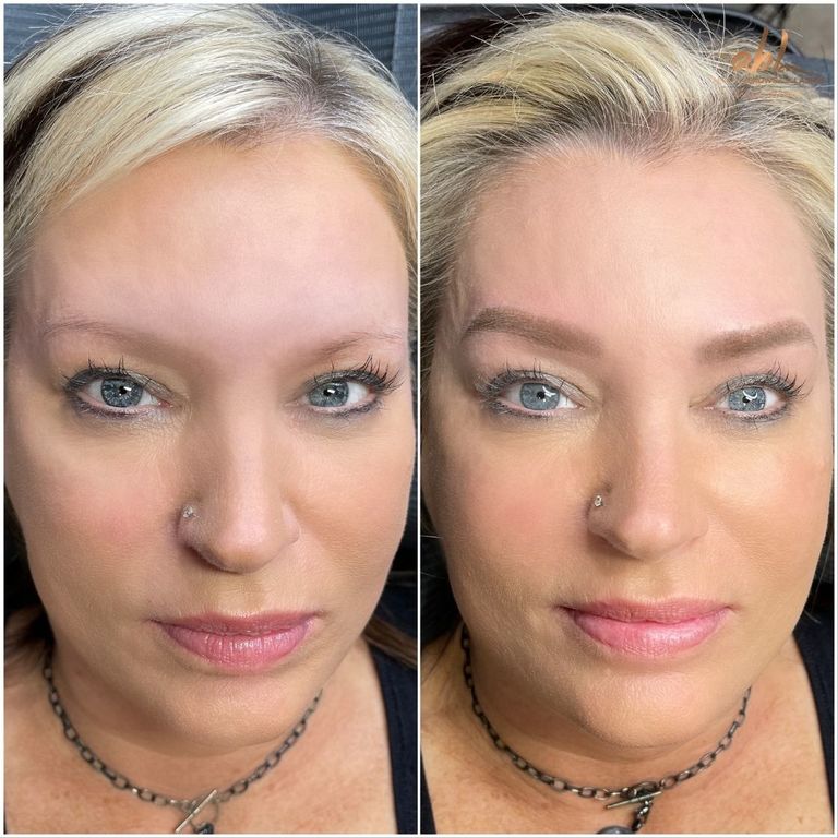 Brow result