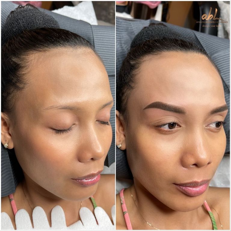 Brow transformation