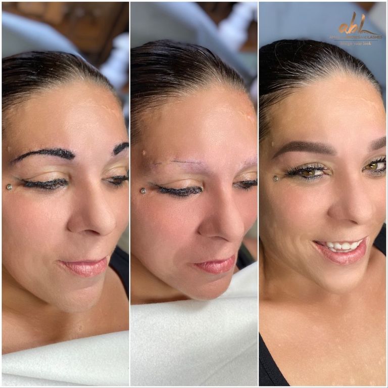 Brow result
