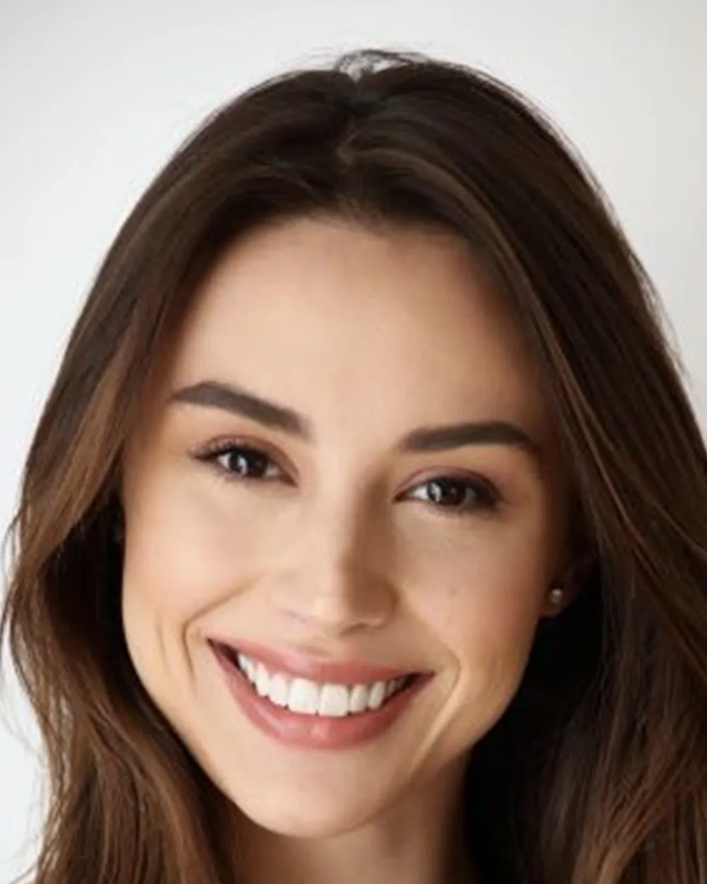 Paciente de Boston Dental & Aesthetics
