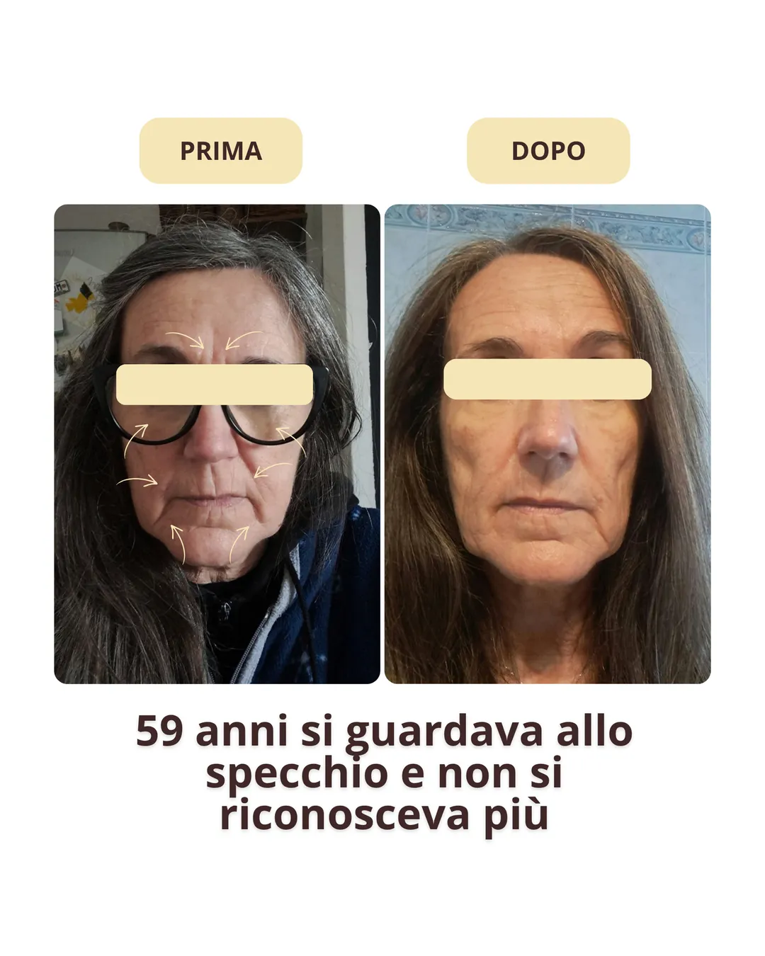 Prima e dopo: cliente di 59 anni che non si riconosceva più allo specchio