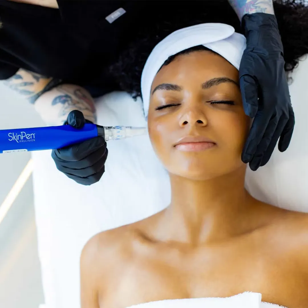 SkinPen microneedling treatment at Vydration