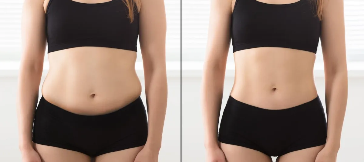 Mamici fara burtici - abdomen transformat