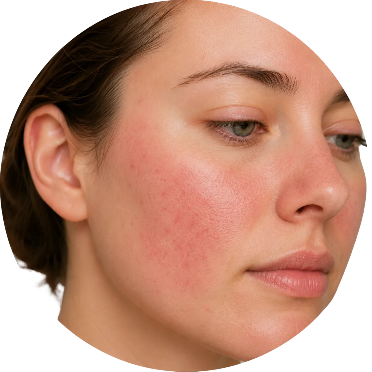 VISIBLE REDNESS