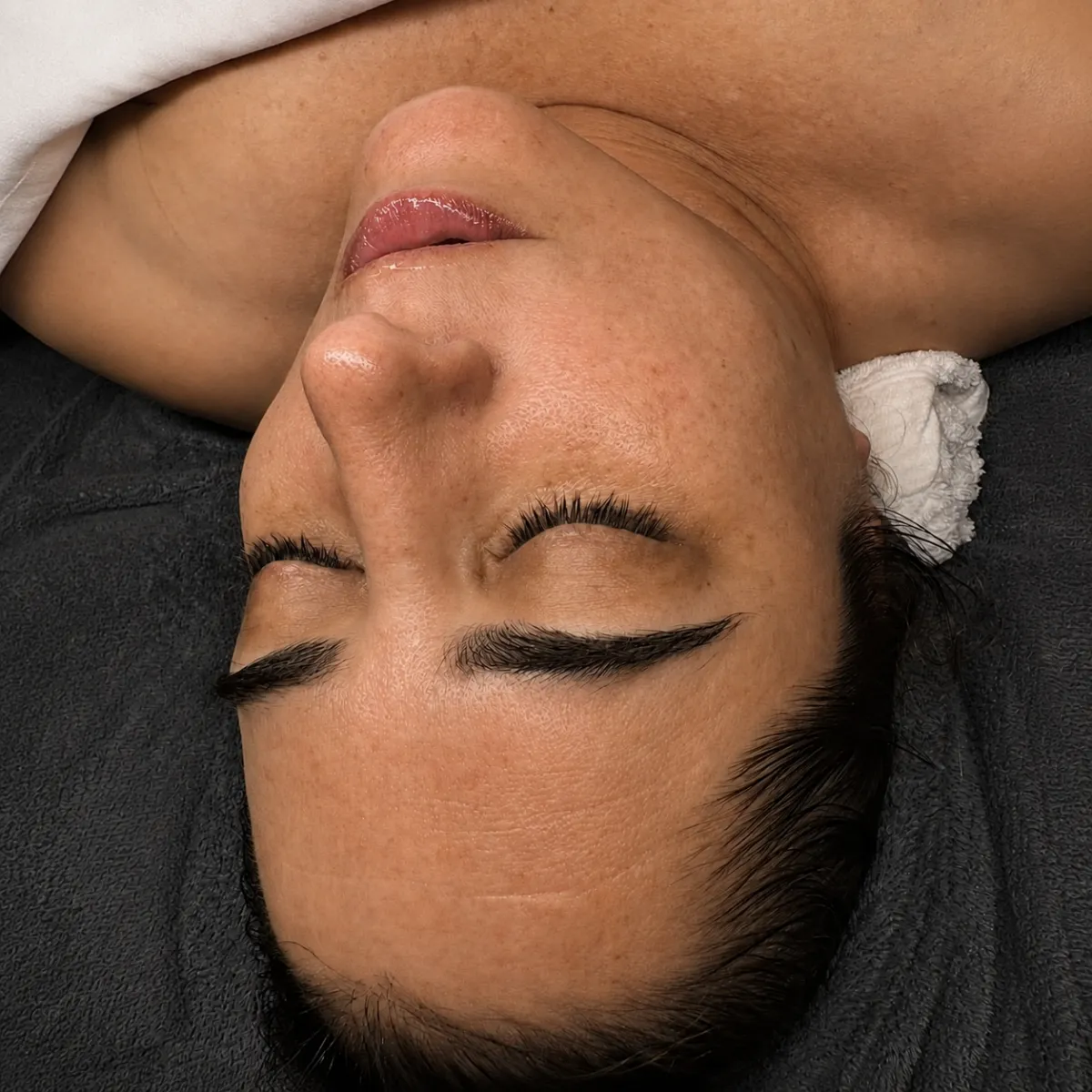 Pigmentation Skin Health Program