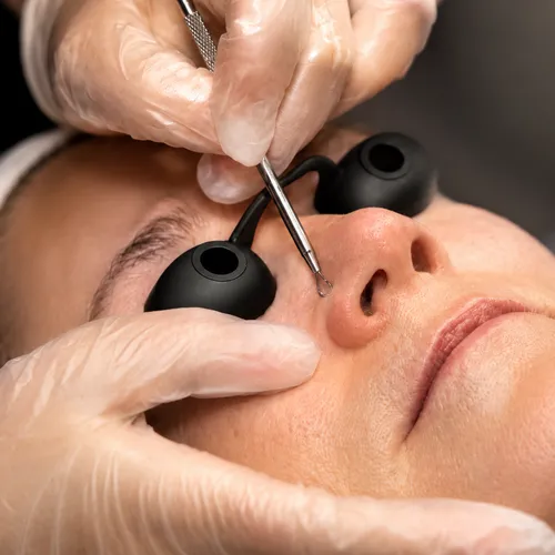 Dermaplaning
