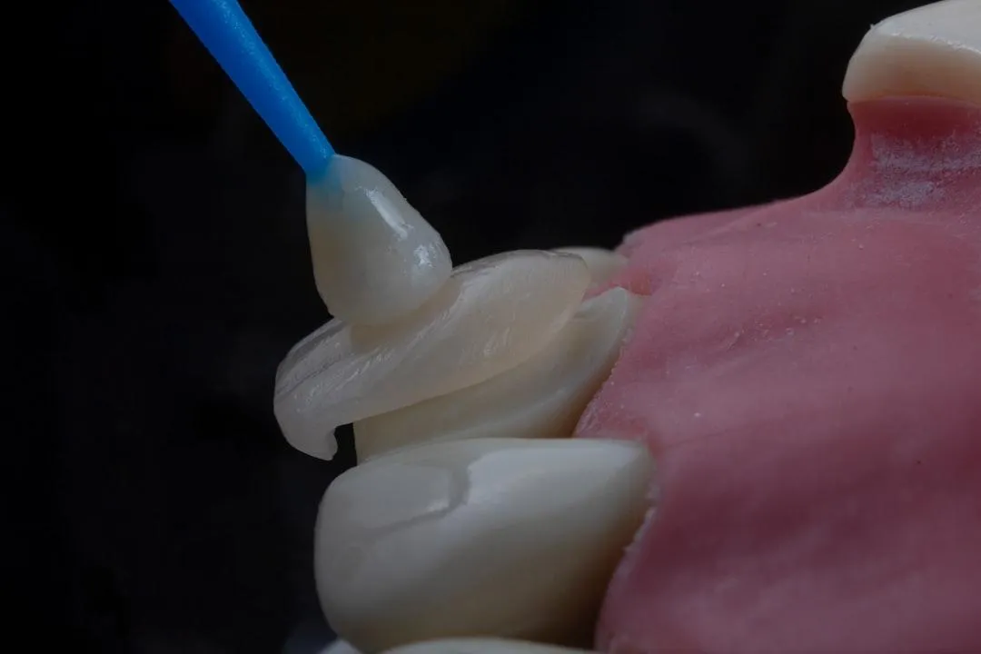 flexible dentures
