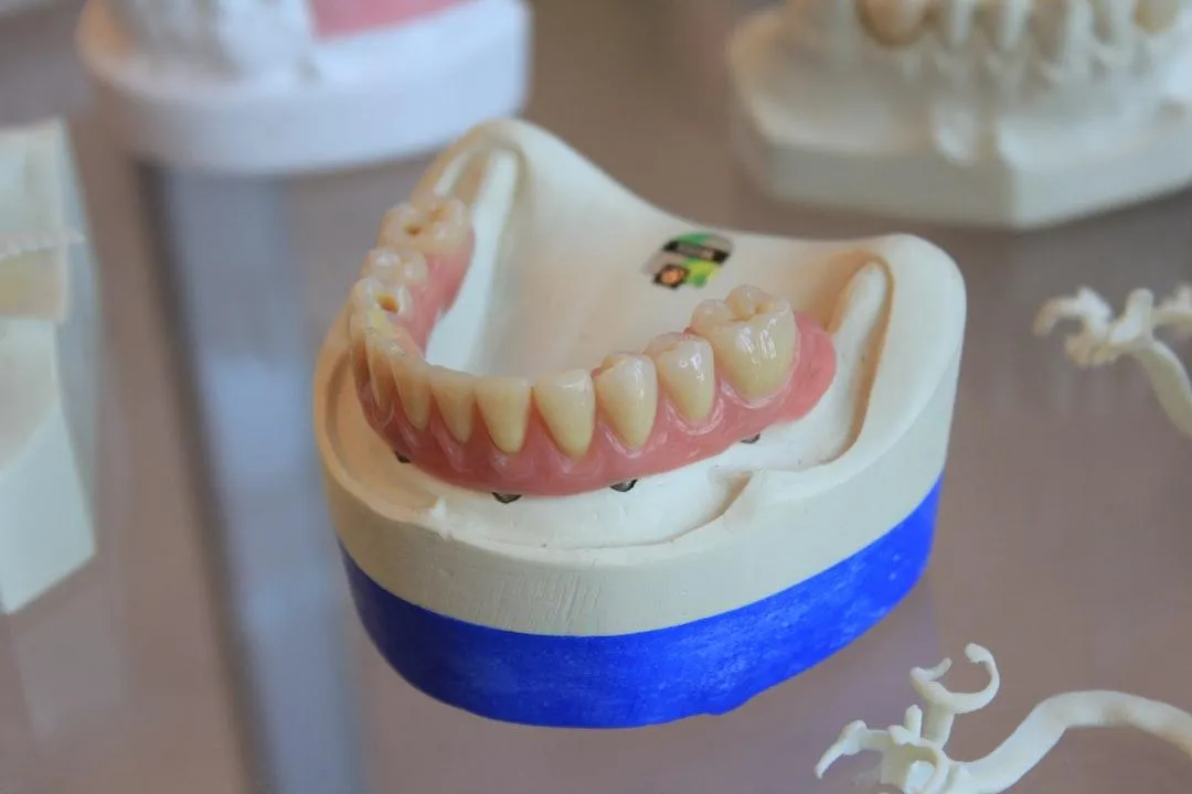 hybrid dentures