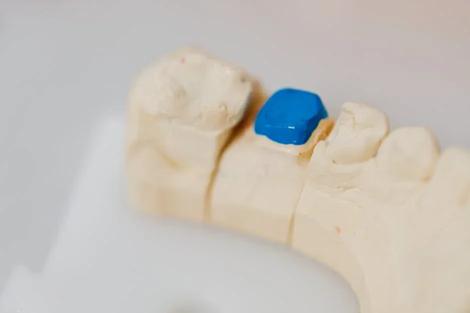 dental crowns Bradenton