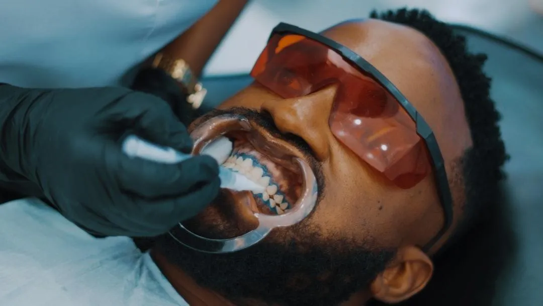 scaling and polishing dental cleaning session