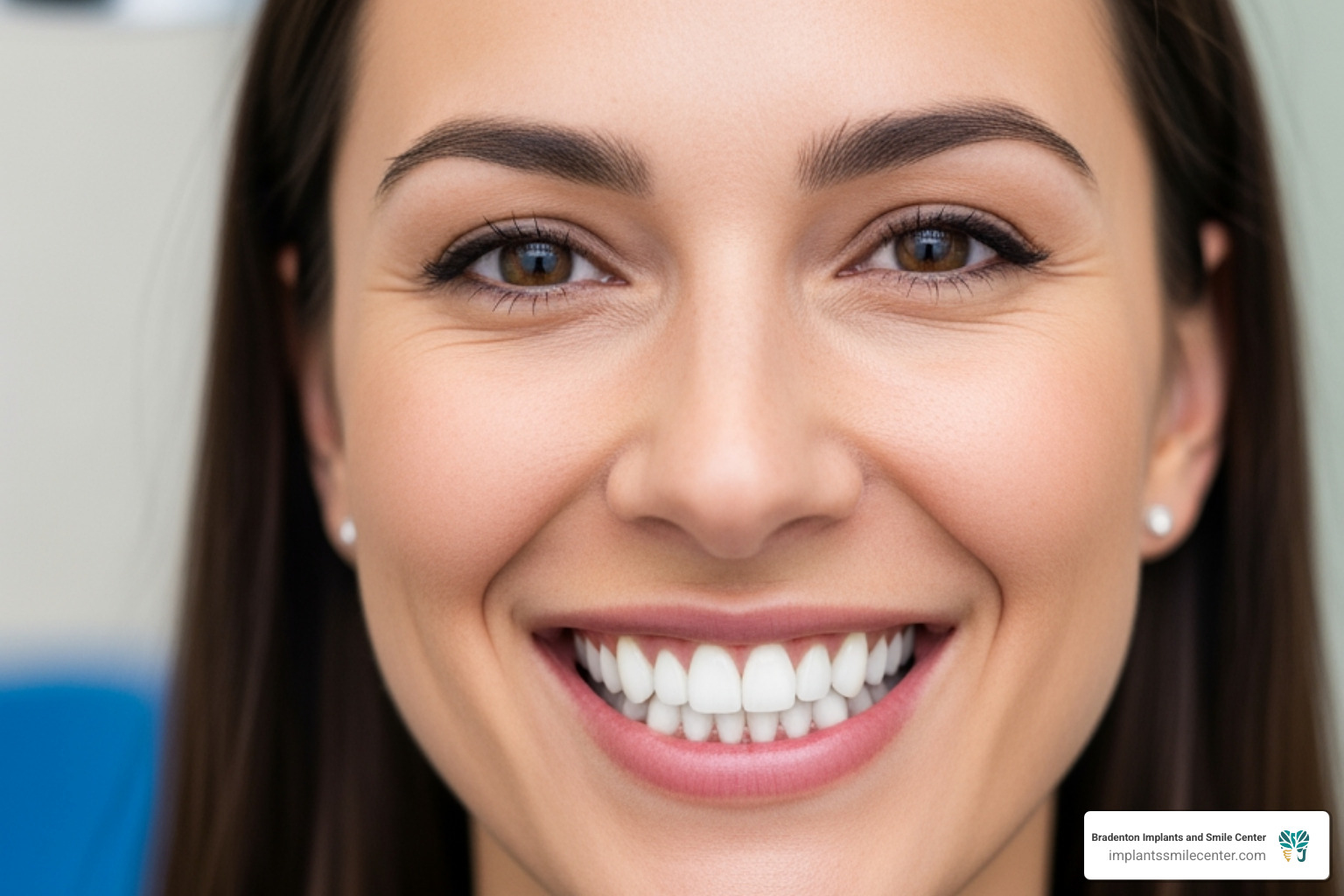 full mouth dental implants in one day