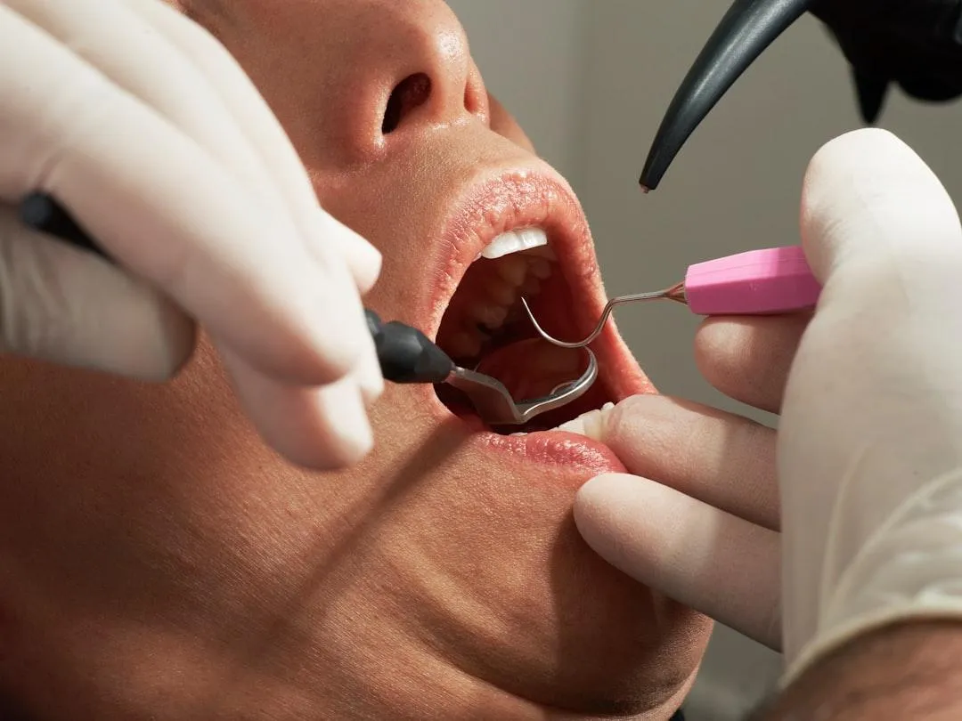same day teeth pulling emergency dental pain