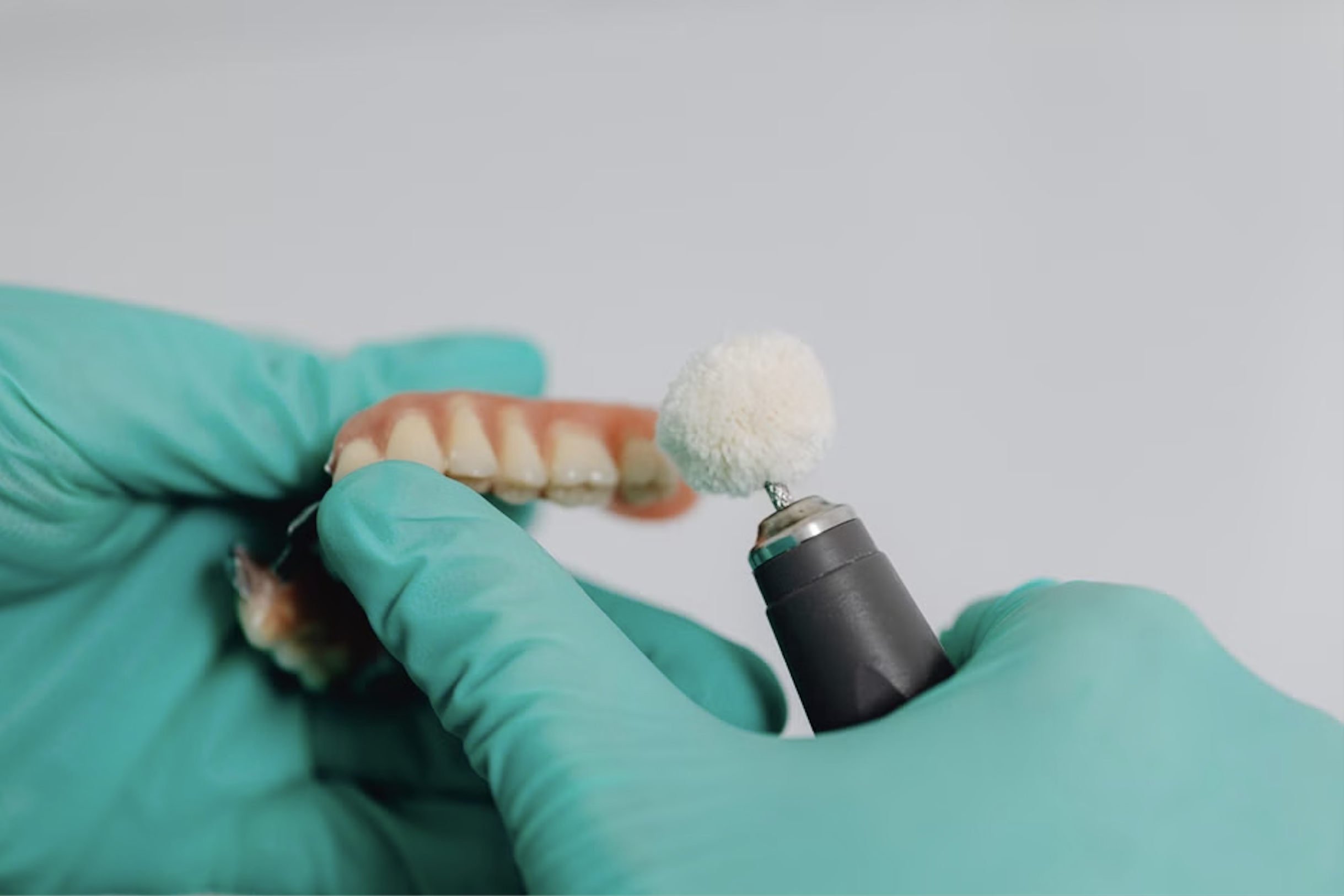 full arch implants cost
