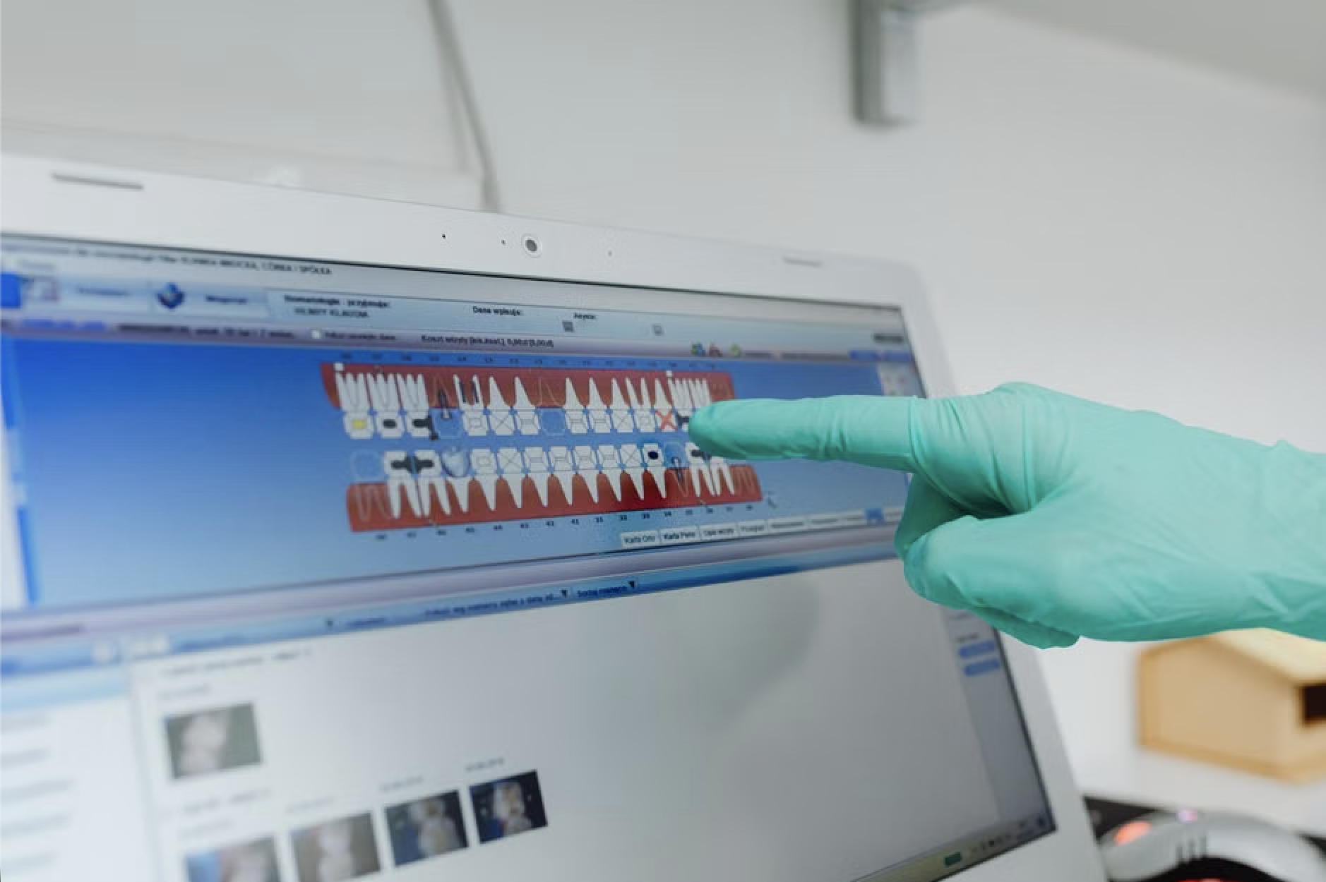 3D computer-guided dental implant planning software showing sub-millimeter surgical alignment
