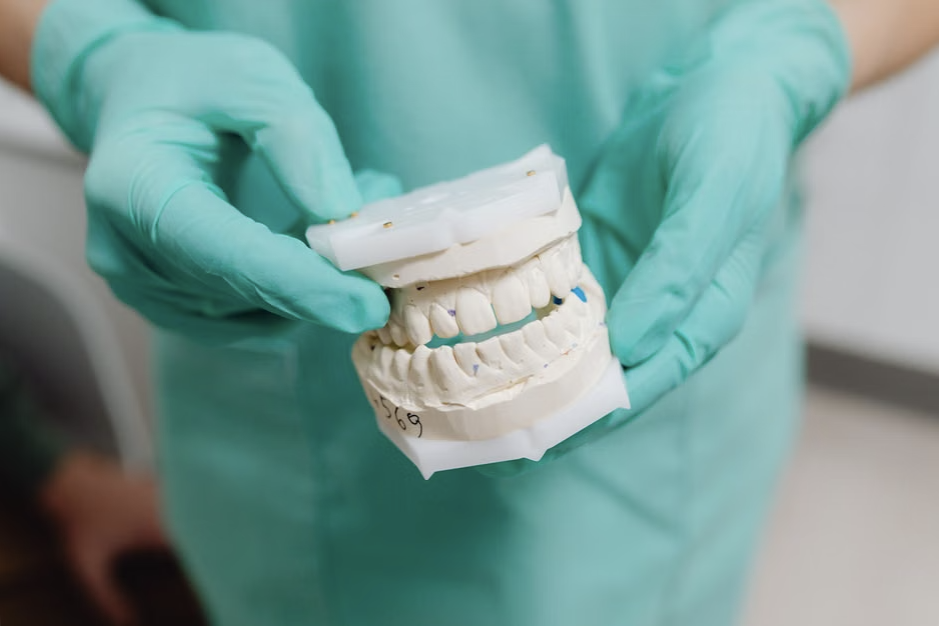 Comparison of full arch dental prosthetics and bridge designs