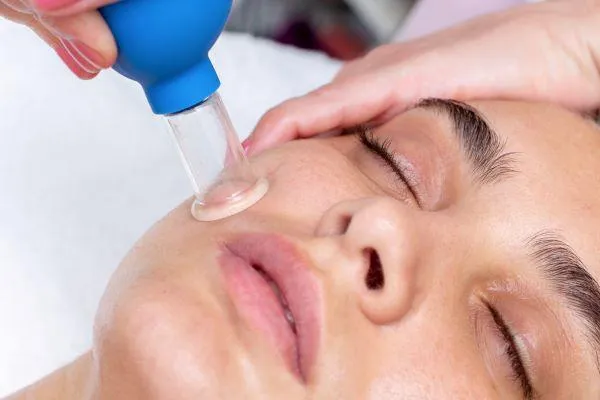 A relaxed woman with her eyes closed receives a facial cupping treatment.