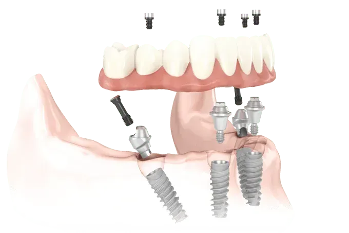 Dentist in Bingham Farms MI | Warm and inviting dental office interior / Dr. Mati DDS | Advanced Dentistry Center