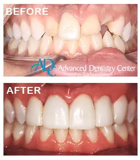 Affordable dental implant solutions display with Dr. Mati DDS