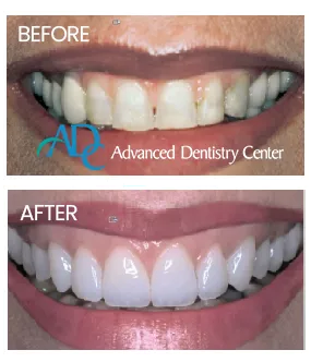 Clinical setup showing tooth replacement surgery with Dr. Rita Bano
