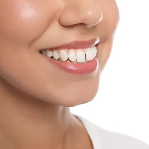 dental crowns