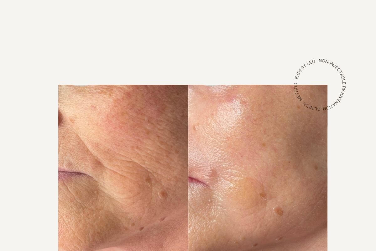 age-reversal-ethos-liberty-hall-before-and-after-client-result.