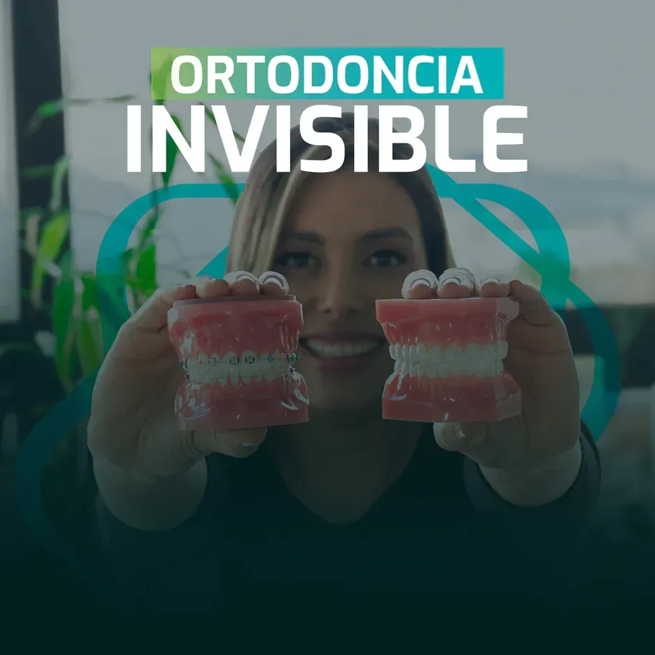 a close up of a person's mouth with a dental device attached to it